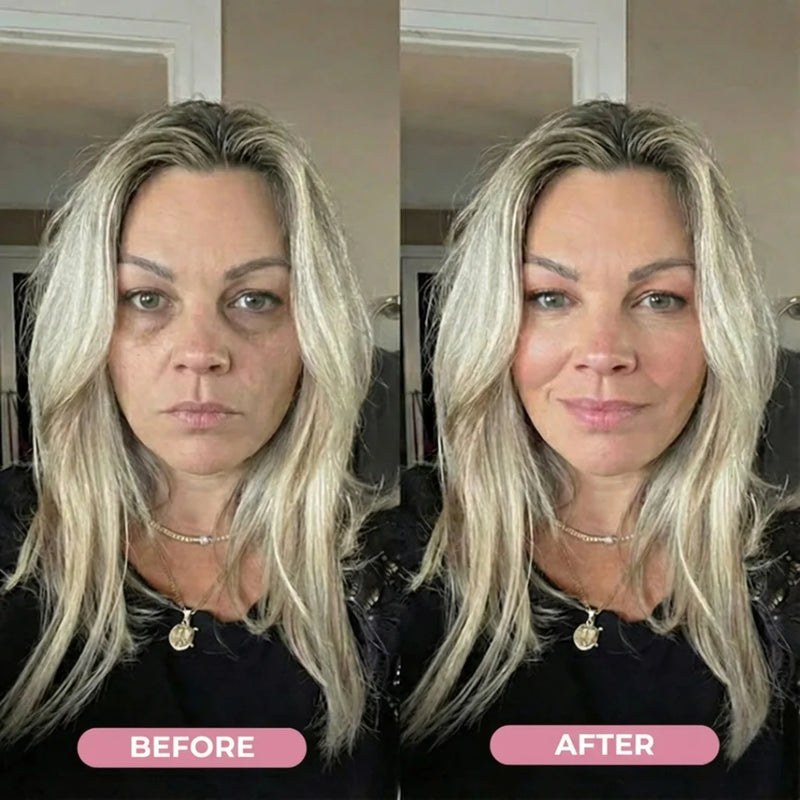 Before and after eye results