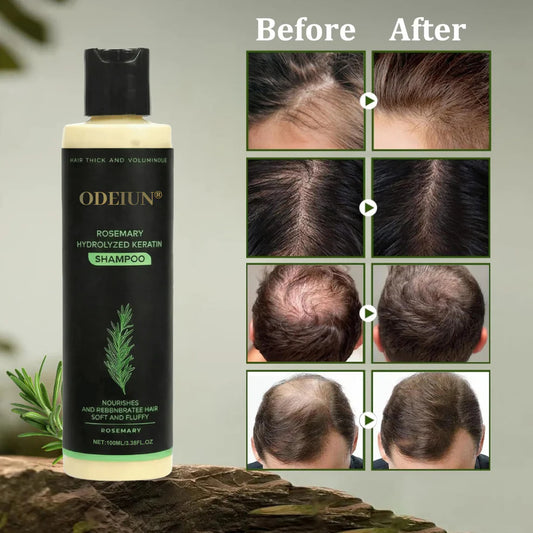 🔥LAST DAY 50% OFF -🌱 Organic Rosemary Hair Growth Shampoo