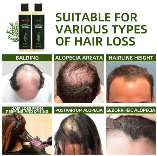 🔥LAST DAY 50% OFF -🌱 Organic Rosemary Hair Growth Shampoo