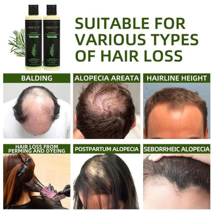 🔥LAST DAY 50% OFF -🌱 Organic Rosemary Hair Growth Shampoo