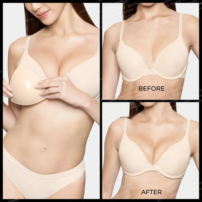 Invisible Lift Inserts