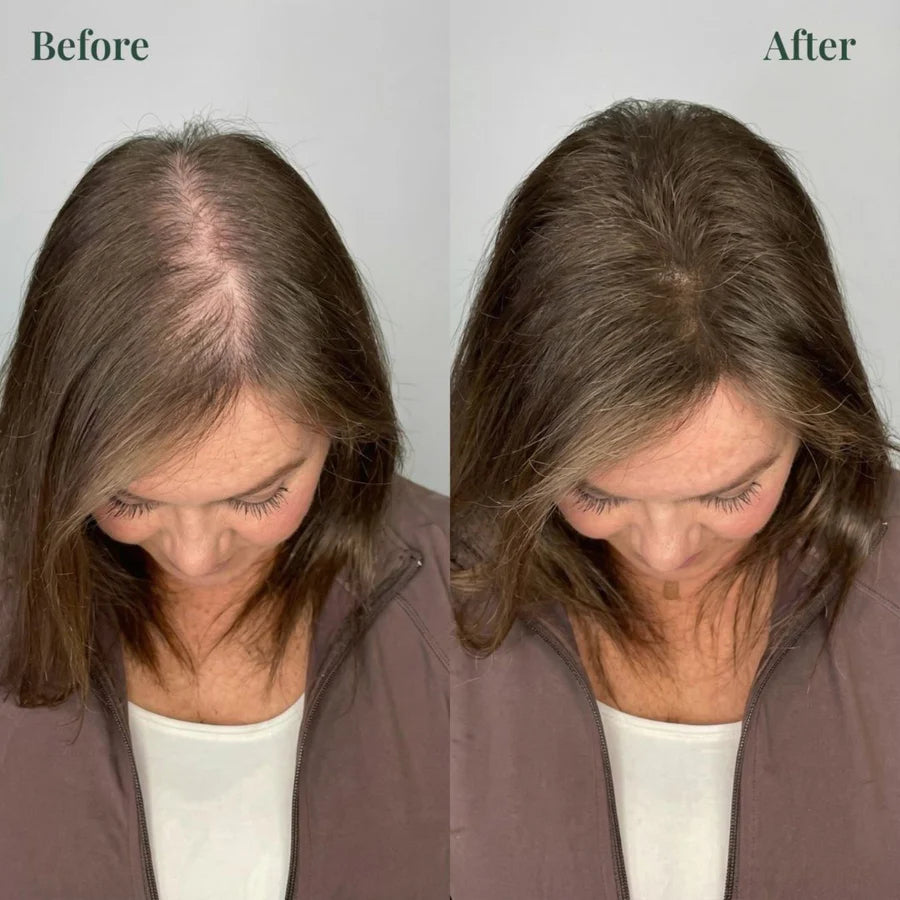 🔥LAST DAY 50% OFF -🌱 Organic Rosemary Hair Growth Shampoo